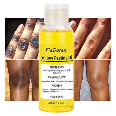 Yellow Peeling Oil Lighten Dark Spots Acne Melanin Skin Bleaching Peeling Oil $10.66