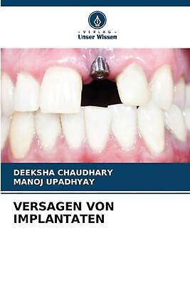 #ad Versagen Von Implantaten by Deeksha Chaudhary Paperback Book $80.71