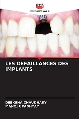 #ad Les Dfaillances Des Implants by Deeksha Chaudhary Paperback Book AU $144.39