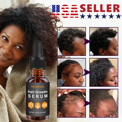 Allurium Beauty Hair Growth Serum Black Women Anti Hair Loss Nourish Hair USA $8.99